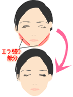 容皮膚科・小顔 ボトックス注射/東京皮膚科・形成外科