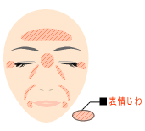 美容皮膚科・しわ治療 ボトックス注射/東京皮膚科・形成外科