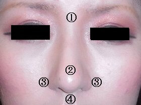 美容外科・鼻手術/東京皮膚科・形成外科